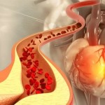 دراسة تفجر مفاجأة.. الكوليسترول الجيد ليس جيداً