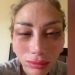 بالفيديو.. ريهام سعيد تكشف كيف تشوهت على يد طبيب تجميل شهير