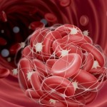 خطر صامت يتسلل إلى الشرايين ويهددنا بجلطات قاتلة