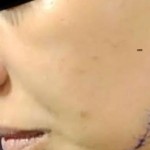 41 غرزة بالوجه.. ضبط سيدة شوهت عروس طليقها قبل أيام من الزفاف