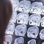 جرعة يومية من الموسيقى قد تكون دواءك ضد الخرف!