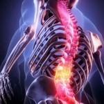 طريقة مبتكرة لإصلاح كسور العمود الفقري بحقنة من خلايا دهنية