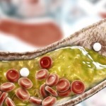 نتائج مذهلة خلال 30 يوما.. نظام غذائي يخفض الكوليسترول كما تفعل الأدوية 