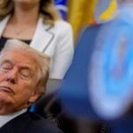 ترامب يفسر الكدمات على يده وينفي النوم أثناء المناسبات