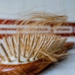 ارتباط بين تساقط الشعر وأمراض خطيرة