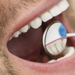 اكتشاف سبب غير متوقع لتدهور صحة الفم والأسنان