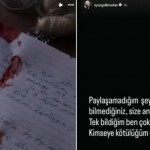 رسالة مكتوبة بالدم.. غموض يلف وفاة مؤثرة تركية والقاتل قد يكون فناناً