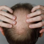 اكتشاف علمي يعيد تفسير آلية نمو الشعر في الجسم