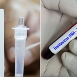 ما الفرق بين هانتا وكورونا؟ وهل من داع للقلق؟