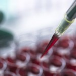 اختراق علمي يغير فهمنا للجهاز المناعي.. آلية مشتركة تجمع بين السرطان وأمراض المناعة الذاتية!