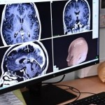 طريقة وحيدة فعالة لإبطاء شيخوخة الدماغ